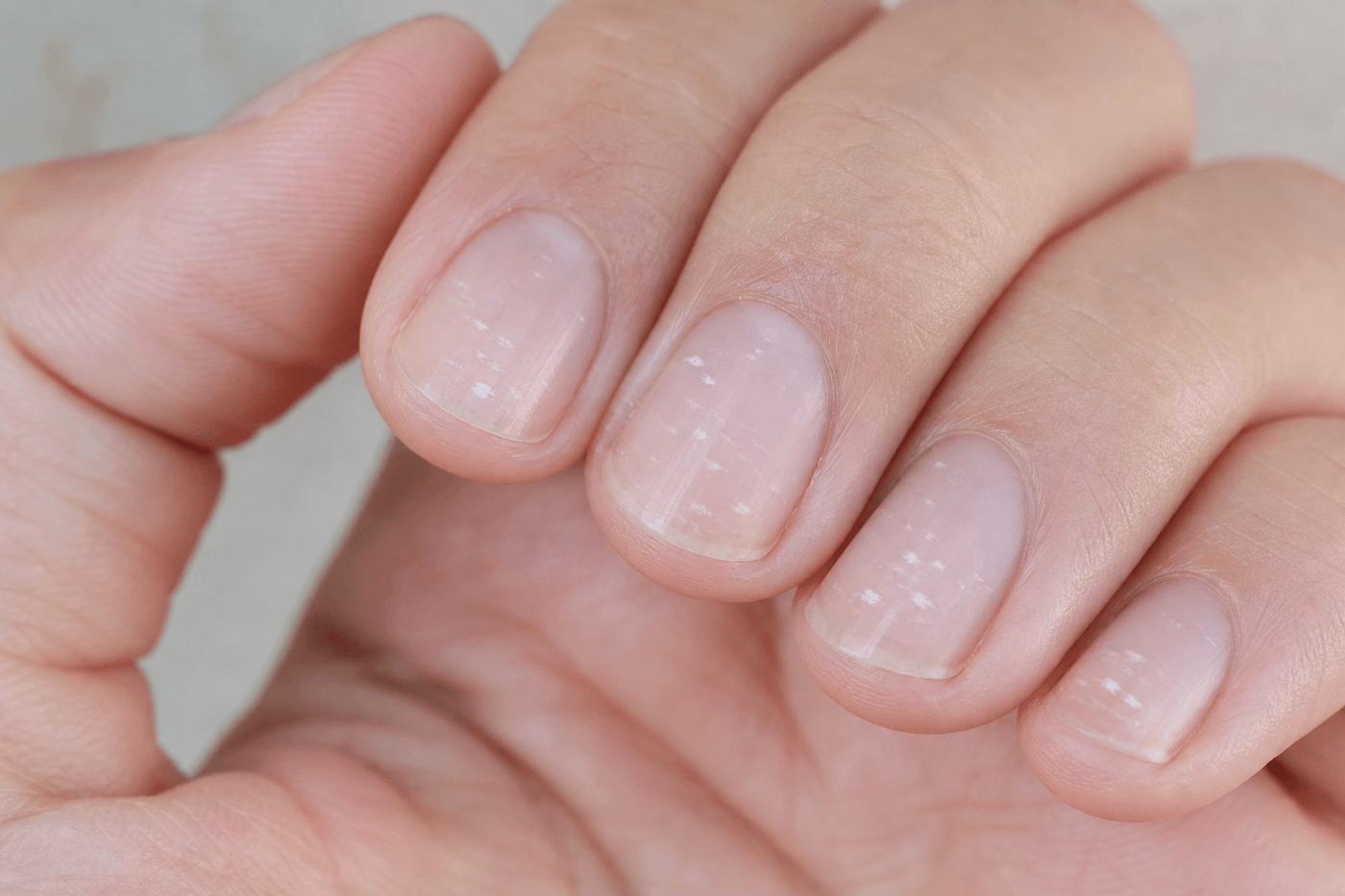 Gros plan sur une main avec des ongles présentant de petites taches blanches